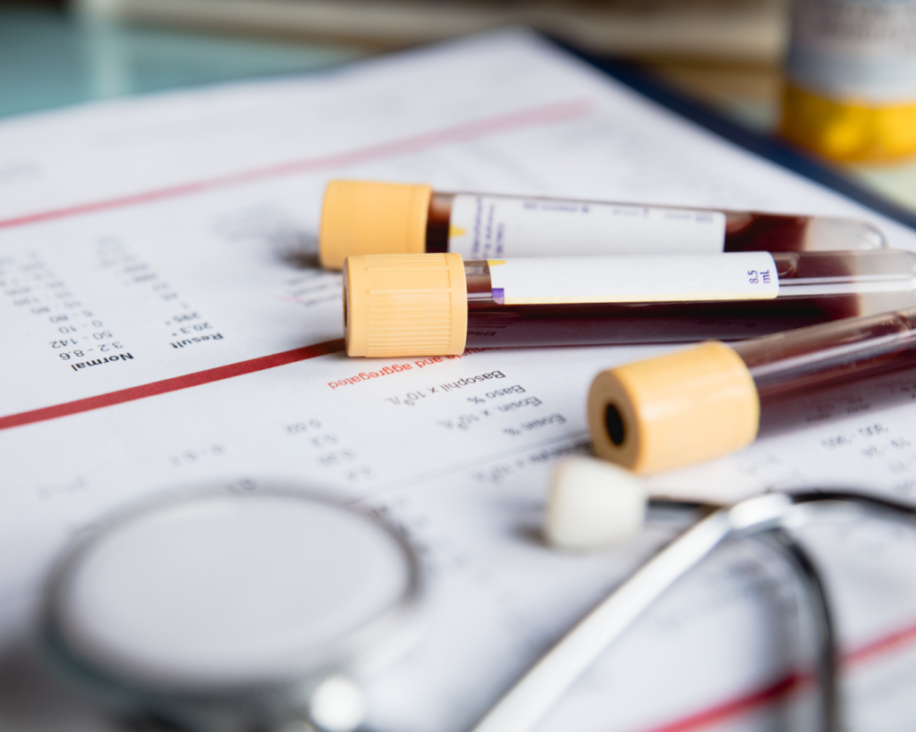 Confidential lab papers with vials of blood and stethoscope resting on it.
