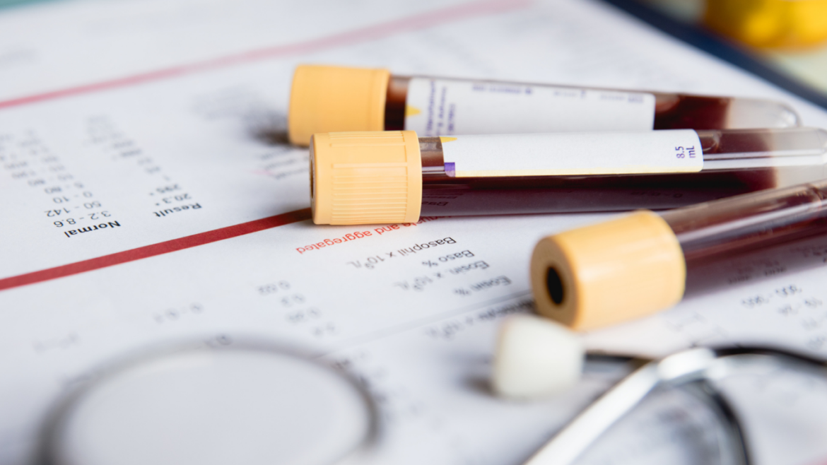 Confidential lab papers with vials of blood and stethoscope resting on it.